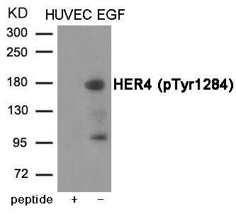 HER4 (Phospho-Tyr1284) Rabbit Polyclonal Antibody, 100 ug HER4 (Phospho-Tyr1284) Rabbit Polyclonal Antibody, 100 ug
