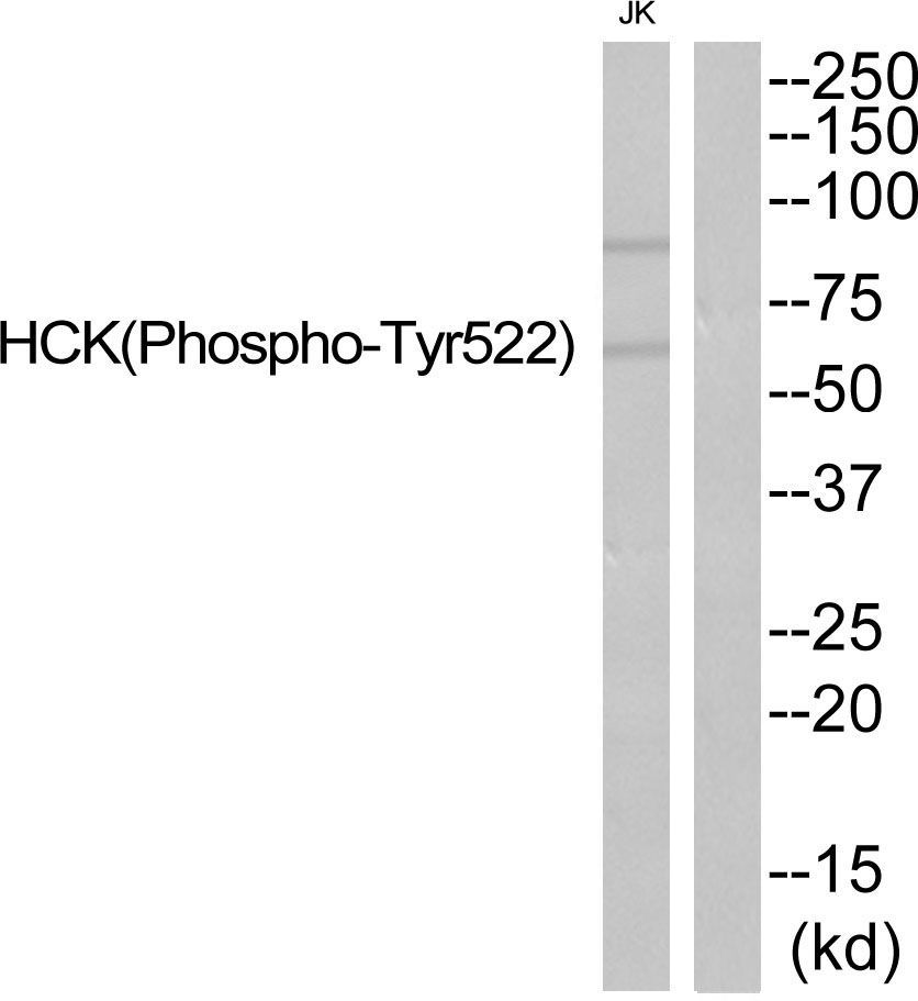 HCK (Phospho-Tyr522) Rabbit Polyclonal Antibody, 100 ug