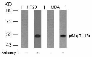 p53 (Phospho-Thr18) Rabbit Polyclonal Antibody, 100 ug