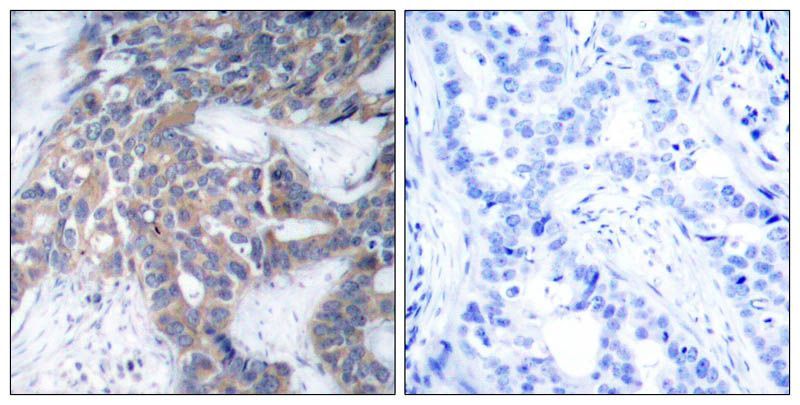 MEK1/MEK2 (Phospho-Ser217/Ser221) Rabbit Polyclonal Antibody, 100 ug