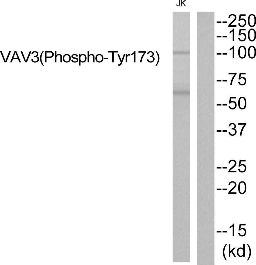 VAV3 (Phospho-Tyr173) Rabbit Polyclonal Antibody, 100 ug