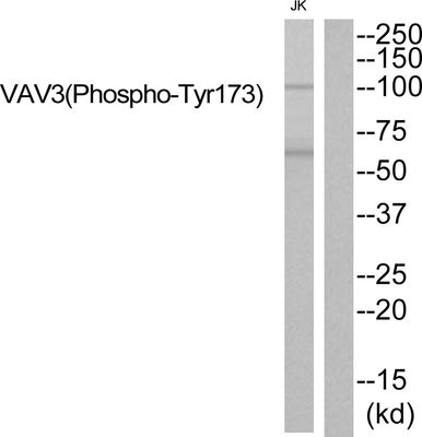 VAV3 (Phospho-Tyr173) Rabbit Polyclonal Antibody, 100 ug