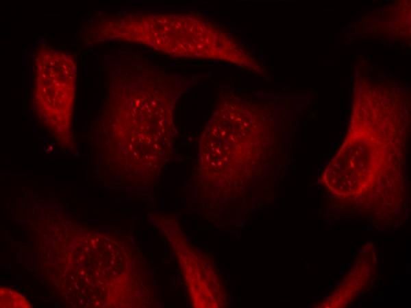FKHRL1(Phospho-Ser253) Rabbit Polyclonal Antibody, 100 ug