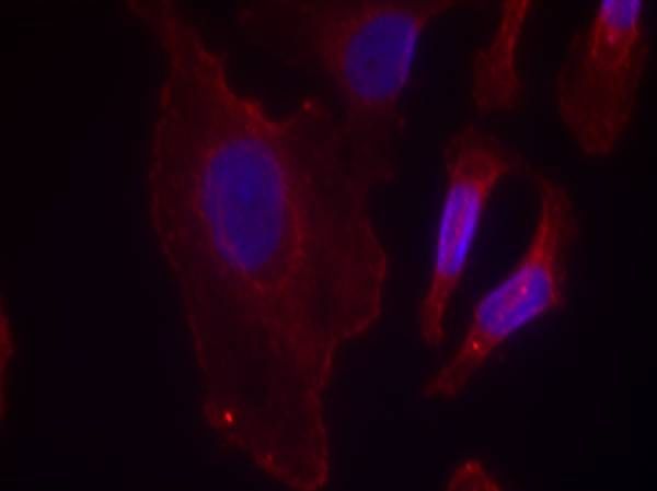 PLCγ2 (Phospho-Tyr753) Rabbit Polyclonal Antibody, 100 ug