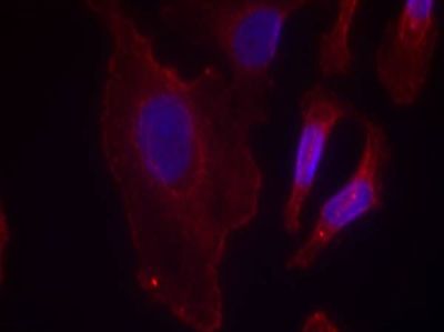 PLCγ2 (Phospho-Tyr753) Rabbit Polyclonal Antibody, 100 ug PLCγ2 (Phospho-Tyr753) Rabbit Polyclonal Antibody, 100 ug