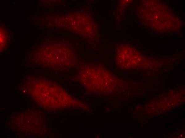 CDK6 (phospho-Tyr24) Rabbit Polyclonal Antibody, 100 ug