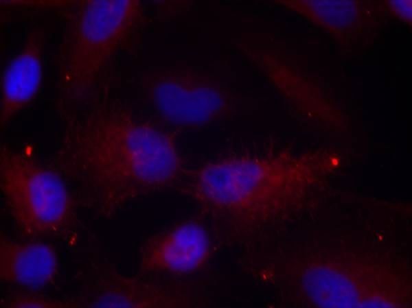 PAK1/PAK2/PAK3 (Phospho-Thr423/Thr402/Thr421) Rabbit Polyclonal Antibody, 100 ug