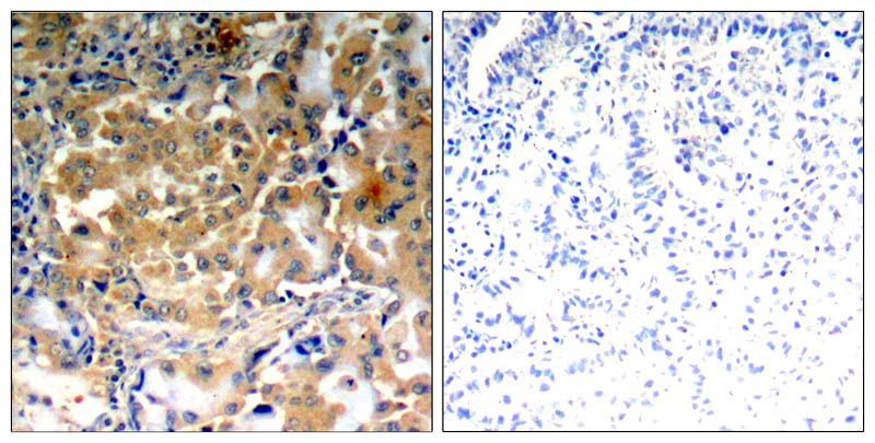 PKCζ(Phospho-Thr410) Rabbit Polyclonal Antibody, 100 ug