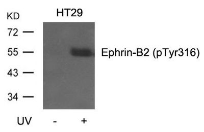Ephrin-B2 (Phospho-Tyr316) Rabbit Polyclonal Antibody, 100 ug