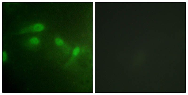 MDM2 (Phospho-Ser186/Ser188) Rabbit Polyclonal Antibody, 100 ug