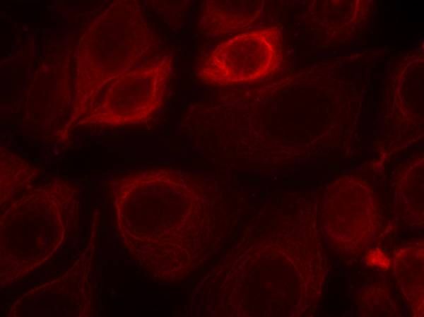 Her3/ErbB3 (phospho-Tyr1328) Rabbit Polyclonal Antibody, 100 ug