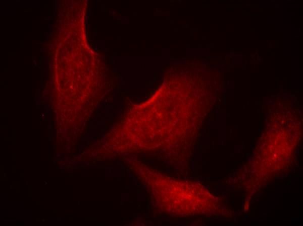 NFκB-p65((phospho-Ser311) Rabbit Polyclonal Antibody, 100 ug
