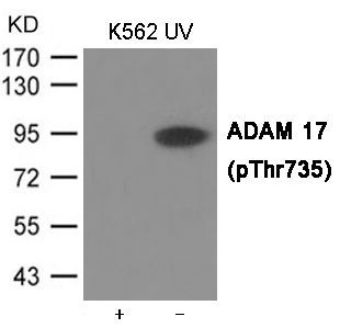 ADAM 17 (Phospho-Thr735) Rabbit Polyclonal Antibody, 100 ug ADAM 17 (Phospho-Thr735) Rabbit Polyclonal Antibody, 100 ug