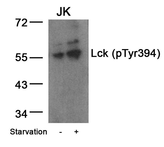 Lck (Phospho-Tyr394) Rabbit Polyclonal Antibody, 100 ug
