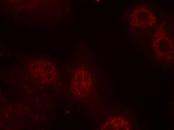 Myc (Phospho-Ser62) Rabbit Polyclonal Antibody, 100 ug