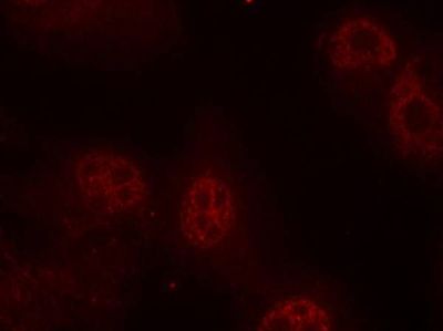 Myc (Phospho-Ser62) Rabbit Polyclonal Antibody, 100 ug