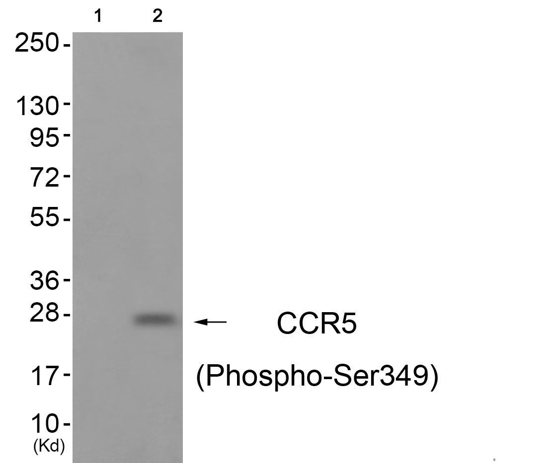 CCR5 (Phospho-Ser349) Rabbit Polyclonal Antibody, 100 ug