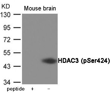 HDAC3 (Phospho-Ser424) Rabbit Polyclonal Antibody, 100 ug
