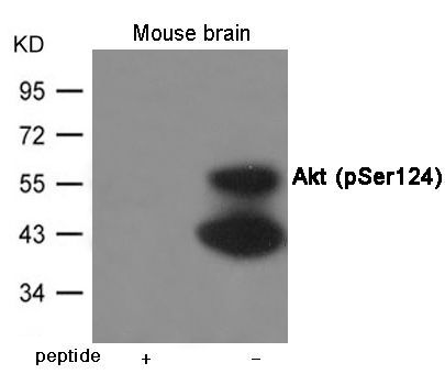 Akt (Phospho-Ser124) Rabbit Polyclonal Antibody, 100 ug