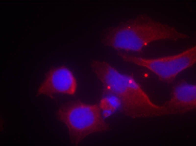 NMDAR2B (phospho-Tyr1474) Rabbit Polyclonal Antibody, 100 ug
