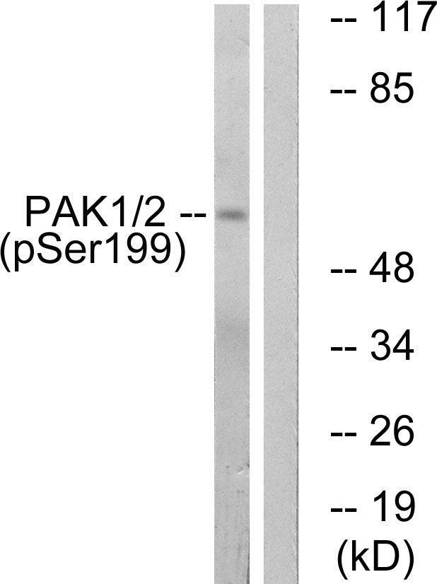 PAK1 (Phospho-Ser199) Rabbit Polyclonal Antibody, 100 ug