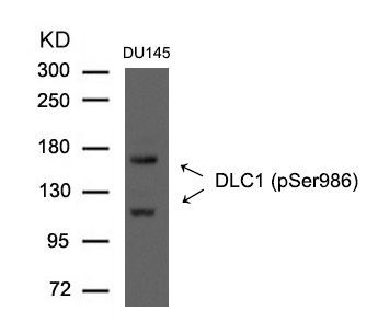 DLC1 (Phospho-Ser986) Rabbit Polyclonal Antibody, 100 ug