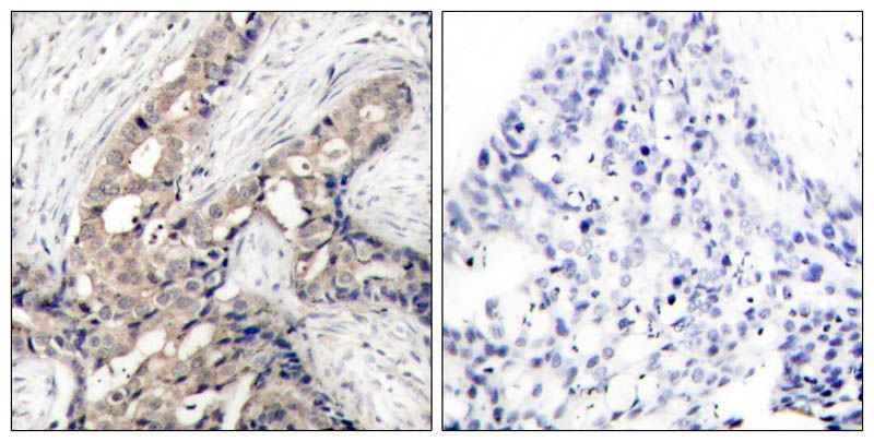 c-Abl(Phospho-Tyr412) Rabbit Polyclonal Antibody, 100 ug