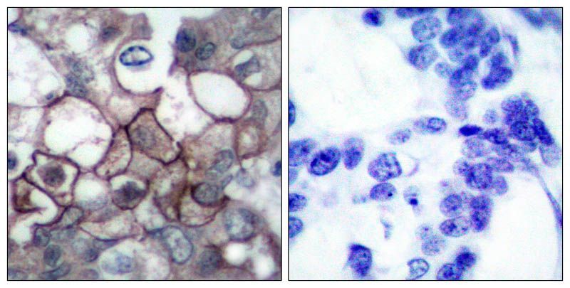 EGFR (Phospho-Tyr1197) Rabbit Polyclonal Antibody, 100 ug