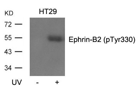 Ephrin-B2 (Phospho-Tyr330) Rabbit Polyclonal Antibody, 100 ug
