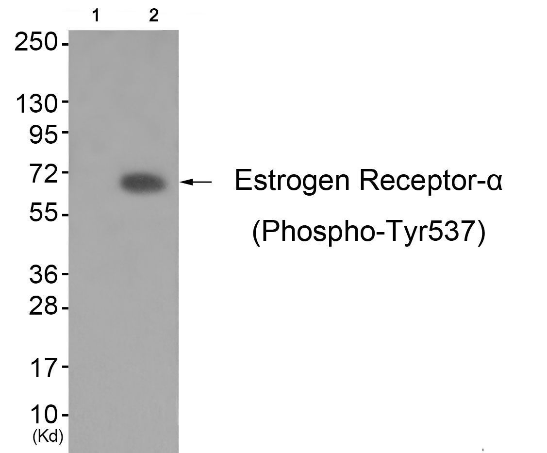 Estrogen Receptor-α (Phospho-Tyr537) Rabbit Polyclonal Antibody, 100 ug