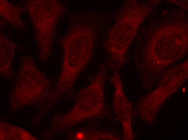 CARM1(Phospho-Ser228) Rabbit Polyclonal Antibody, 100 ug