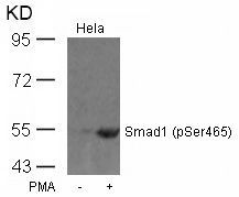 Smad1 (Phospho-Ser465) Rabbit Polyclonal Antibody, 100 ug