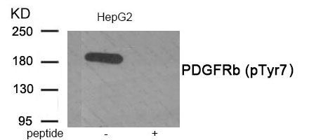 PDGFRb (Phospho-Tyr771) Rabbit Polyclonal Antibody, 100 ug