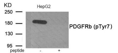 PDGFRb (Phospho-Tyr771) Rabbit Polyclonal Antibody, 100 ug PDGFRb (Phospho-Tyr771) Rabbit Polyclonal Antibody, 100 ug