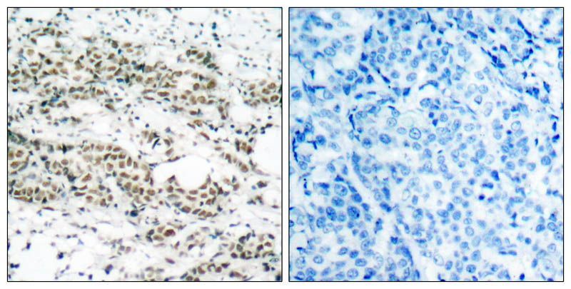 AFX (Phospho-Ser197) Rabbit Polyclonal Antibody, 100 ug