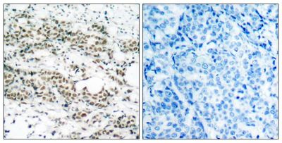 AFX (Phospho-Ser197) Rabbit Polyclonal Antibody, 100 ug AFX (Phospho-Ser197) Rabbit Polyclonal Antibody, 100 ug