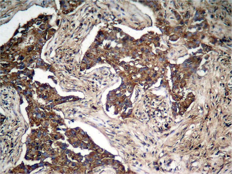 HER2 (Phospho-Tyr1248) Rabbit Polyclonal Antibody, 100 ug