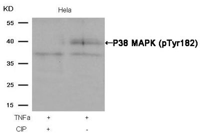 P38 MAPK (Phospho-Tyr182) Rabbit Polyclonal Antibody, 100 ug P38 MAPK (Phospho-Tyr182) Rabbit Polyclonal Antibody, 100 ug