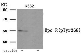 Epo-R (Phospho-Tyr368) Rabbit Polyclonal Antibody, 100 ug