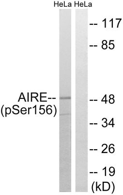 AIRE (Phospho-Ser156) Rabbit Polyclonal Antibody, 100 ug