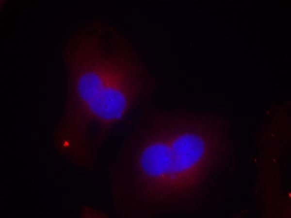FAK (Phospho-Tyr925) Rabbit Polyclonal Antibody, 100 ug