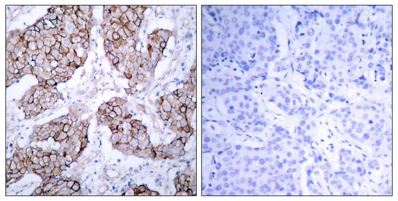 EGFR (Phospho-Tyr1092) Rabbit Polyclonal Antibody, 100 ug