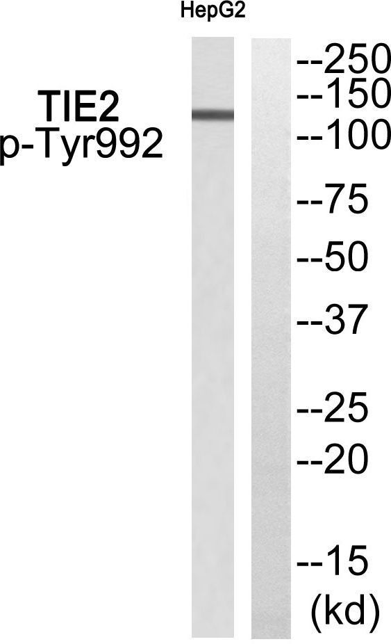TIE2 (Phospho-Tyr992) Rabbit Polyclonal Antibody, 100 ug