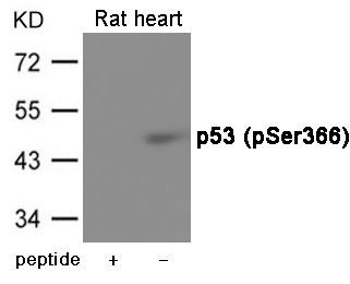 p53 (Phospho-Ser366) Rabbit Polyclonal Antibody, 100 ug