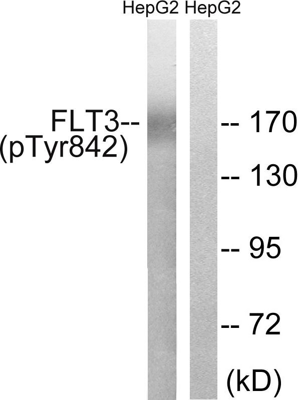 FLT3 (Phospho-Tyr842) Rabbit Polyclonal Antibody, 100 ug
