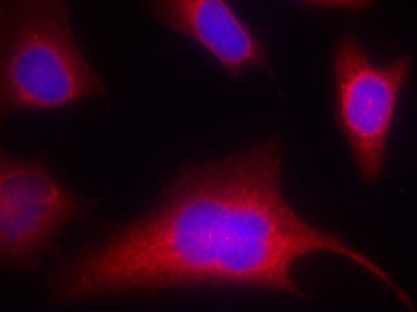 PKD/PKCμ (Phospho-Ser910) Rabbit Polyclonal Antibody, 100 ug