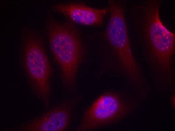 SEK1/MKK4 (Phospho-Ser80) Rabbit Polyclonal Antibody, 100 ug