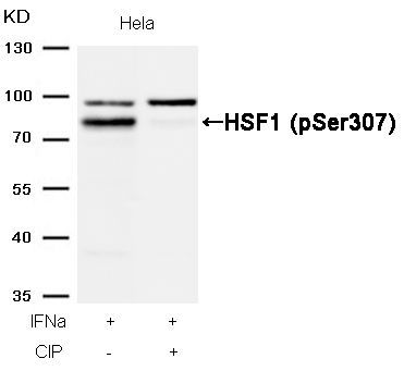 HSF1 (Phospho-Ser307) Rabbit Polyclonal Antibody, 100 ug