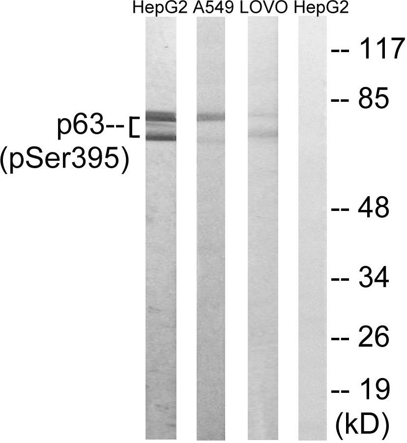 p63 (Phospho-Ser395) Rabbit Polyclonal Antibody, 100 ug