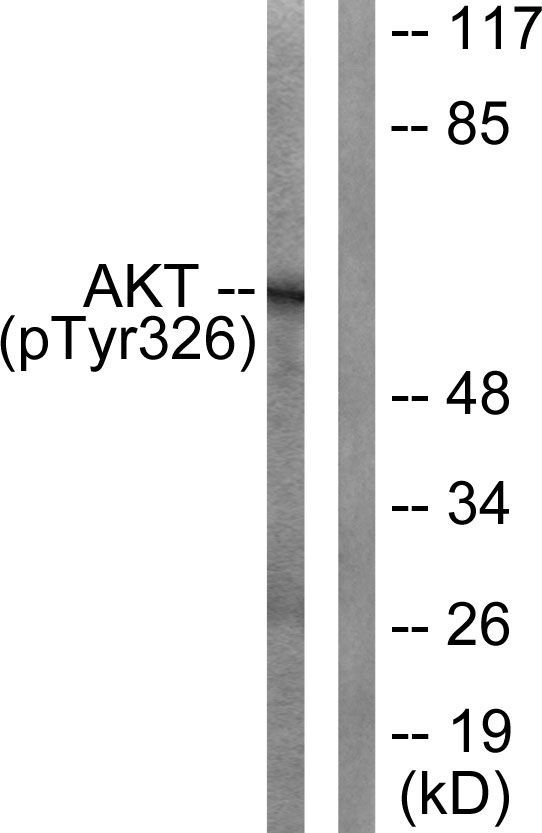 Akt (Phospho-Tyr326) Rabbit Polyclonal Antibody, 100 ug